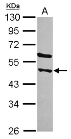 AMSH-LP Antibody, Novus Biologicals 0.1 mL | Buy Online | Novus Biologicals | Fisher Scientific
