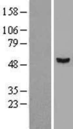 Novus Biologicals&trade;&nbsp;AMSH-LP Overexpression Lysate