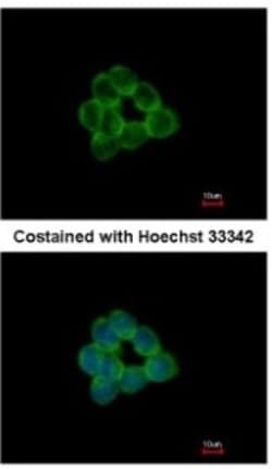 STAP2 Antibody, Novus Biologicals 0.1mg; Unlabeled:Antibodies, Polyclonal