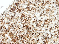 STAP2 Antibody, Novus Biologicals 0.1mg; Unlabeled:Antibodies, Polyclonal