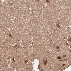 STAP2 Antibody, Novus Biologicals 0.1mL; Unlabeled:Antibodies, Polyclonal