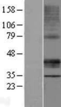 Novus Biologicals STARD3 Overexpression Lysate 0,1 mg | Buy Online | Novus Biologicals&trade; | Fisher Scientific