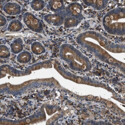 STARD3NL Antibody, Novus Biologicals 0.1mL; Unlabeled:Antibodies, Polyclonal