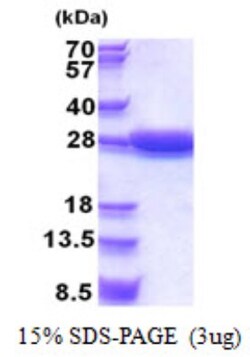 Novus Biologicals Recombinant Human STARD5 His Protein 0.1 mg | Buy Online | Novus Biologicals&trade; | Fisher Scientific