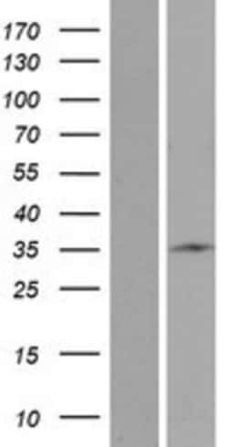 Novus Biologicals&trade;&nbsp;STARD6 Overexpression Lysate