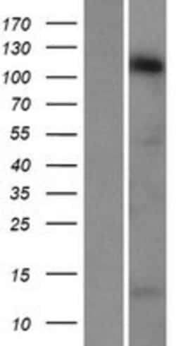 Novus Biologicals™ STARD8 Overexpression Lysate