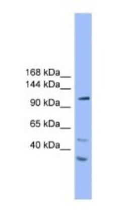 STARD8 Antibody, Novus Biologicals 100&mu;L; Unlabeled:Antibodies, Polyclonal