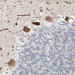 STARD9 Antibody, Novus Biologicals:Antibodies:Primary Antibodies