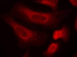 STAT1, p Ser727 Antibody, Novus Biologicals 0.025 mL; Unconjugated:Antibodies,
