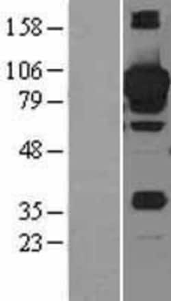 Novus Biologicals&trade;&nbsp;STAT3 Overexpression Lysate
