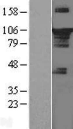 Novus Biologicals&trade;&nbsp;STAT3 Overexpression Lysate