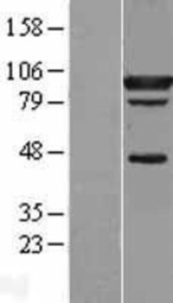 Novus Biologicals&trade;&nbsp;STAT5A Overexpression Lysate