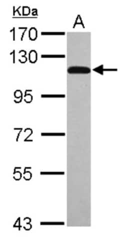 STAT6 Antibody, Novus Biologicals 0.1mL; Unlabeled:Antibodies, Polyclonal