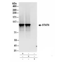 STAT6 Antibody, Novus Biologicals 0.1mg; Unlabeled:Antibodies, Polyclonal