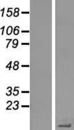 Novus Biologicals&trade;&nbsp;STATH Overexpression Lysate