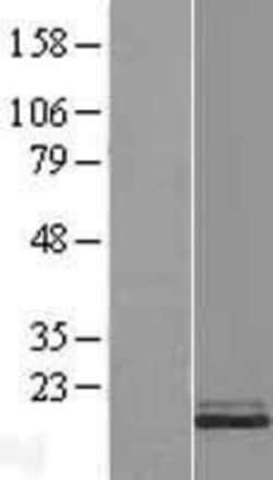 Novus Biologicals&trade;&nbsp;Stathmin 1 Overexpression Lysate