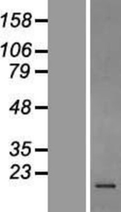 Novus Biologicals&trade;&nbsp;Stathmin 1 Overexpression Lysate