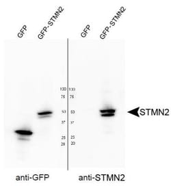 Stathmin-2/STMN2 Antibody, Novus Biologicals 0.05mL; Unlabeled:Antibodies,