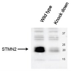 Stathmin-2/STMN2 Antibody, Novus Biologicals 0.05mL; Unlabeled:Antibodies,