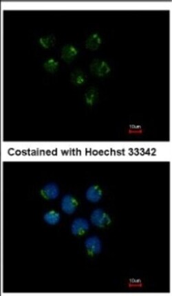 STAU2 Antibody, Novus Biologicals 0.1mL; Unlabeled:Antibodies, Polyclonal