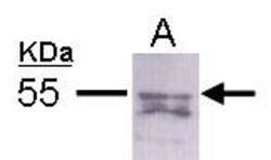 STAU2 Antibody, Novus Biologicals 0.1mL; Unlabeled:Antibodies, Polyclonal