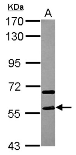 STAU2 Antibody, Novus Biologicals 0.1mL; Unlabeled:Antibodies, Polyclonal