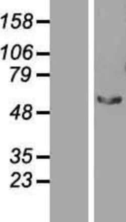 Novus Biologicals&trade;&nbsp;STAU2 Overexpression Lysate