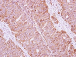Staufen Antibody, Novus Biologicals 0.1mL; Unlabeled:Antibodies, Polyclonal