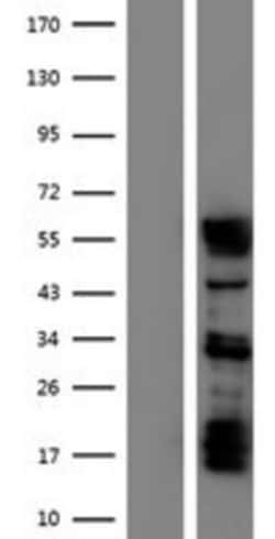 Novus Biologicals&trade;&nbsp;Staufen Overexpression Lysate