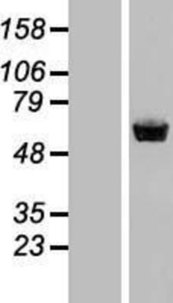 Novus Biologicals&trade;&nbsp;Staufen Overexpression Lysate
