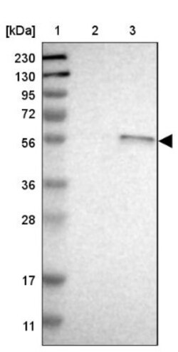 STCH Antibody, Novus Biologicals:Antibodies:Primary Antibodies