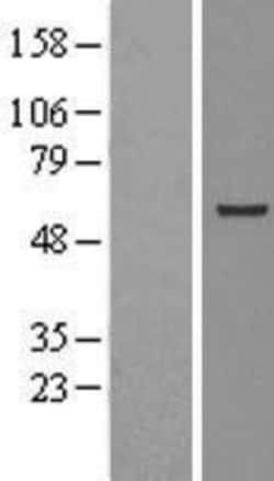 Novus Biologicals&trade;&nbsp;STCH Overexpression Lysate