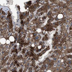 STCH Antibody, Novus Biologicals:Antibodies:Primary Antibodies