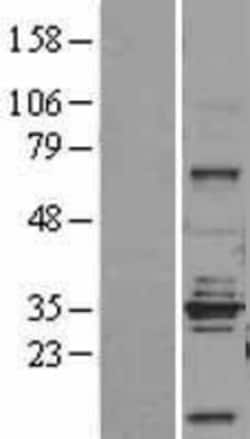 Novus Biologicals&trade;&nbsp;STEAP1 Overexpression Lysate