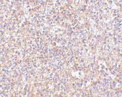 STEAP1 Antibody - BSA Free, Novus Biologicals 0.1mg; Unlabeled:Antibodies,