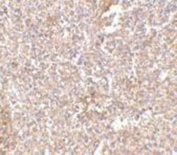 STEAP1 Antibody - BSA Free, Novus Biologicals 0.025 mg | Buy Online | Novus Biologicals | Fisher Scientific