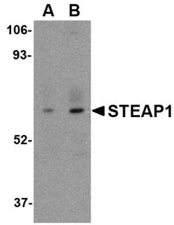 STEAP1 Antibody - BSA Free, Novus Biologicals 0.1mg; Unlabeled:Antibodies,