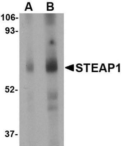 STEAP1 Antibody - BSA Free, Novus Biologicals 0.025 mg | Buy Online | Novus Biologicals | Fisher Scientific