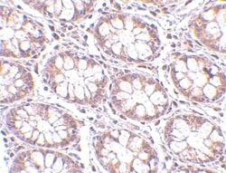 STEAP2 Antibody - BSA Free, Novus Biologicals:Antibodies:Primary Antibodies