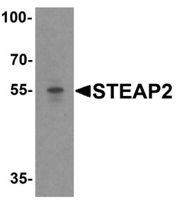 STEAP2 Antibody - BSA Free, Novus Biologicals 0.025 mg, Unconjugated:Antibodies,