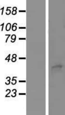 Novus Biologicals&trade;&nbsp;STEAP3/TSAP6 Overexpression Lysate
