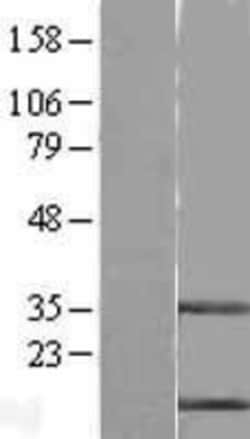 Novus Biologicals&trade;&nbsp;Cystatin B/Stefin B Overexpression Lysate