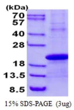 Novus Biologicals&trade;&nbsp;Recombinant Human Stella/Dppa3 His Protein