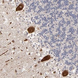 Steroid sulfatase Antibody, Novus Biologicals 0.1mL; Unlabeled:Antibodies,