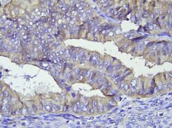 Steroid sulfatase Antibody, Novus Biologicals 0.05mg; Unlabeled:Antibodies,