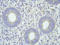 Steroid sulfatase Antibody, Novus Biologicals 0.05mg; Unlabeled:Antibodies,