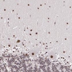 STG Antibody, Novus Biologicals:Antibodies:Primary Antibodies