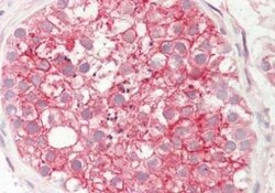 STIM1 Antibody, Novus Biologicals 100ug:Antibodies, Polyclonal