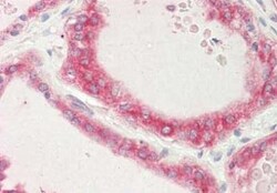 STIM1 Antibody, Novus Biologicals 100ug:Antibodies, Polyclonal