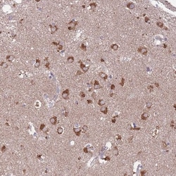STIM2 Antibody, Novus Biologicals 0.1mL; Unlabeled:Antibodies, Polyclonal